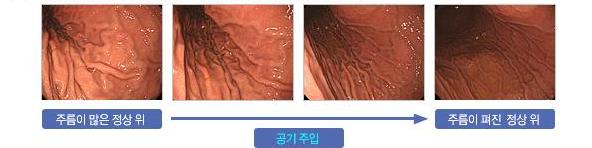 위의 주름
