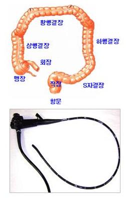 대장 구조와 내시경