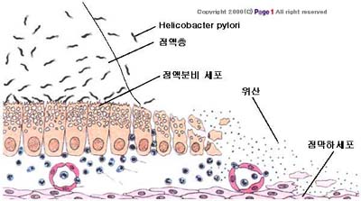 헬리코박터 파이로리균 형태