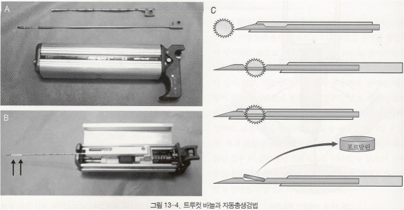 총 조직검사