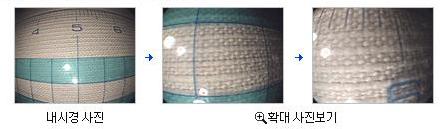 대장 내시경 해상도 사진