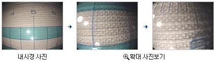 위내시경 해상도 사진