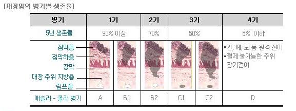 대장암 치료