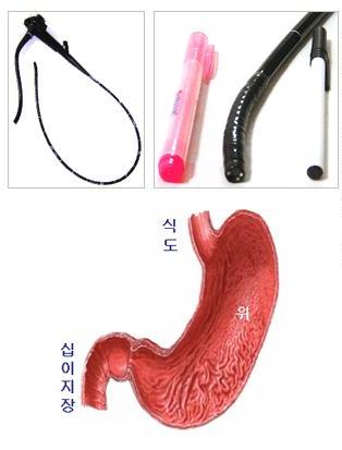 위내시경 기구